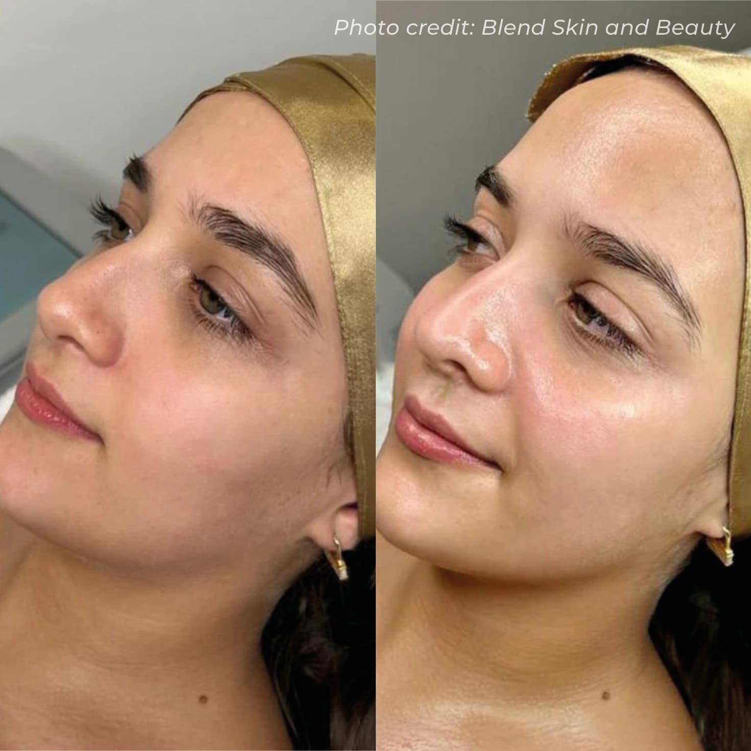 Deep Pore Refining & Hydration Therapy