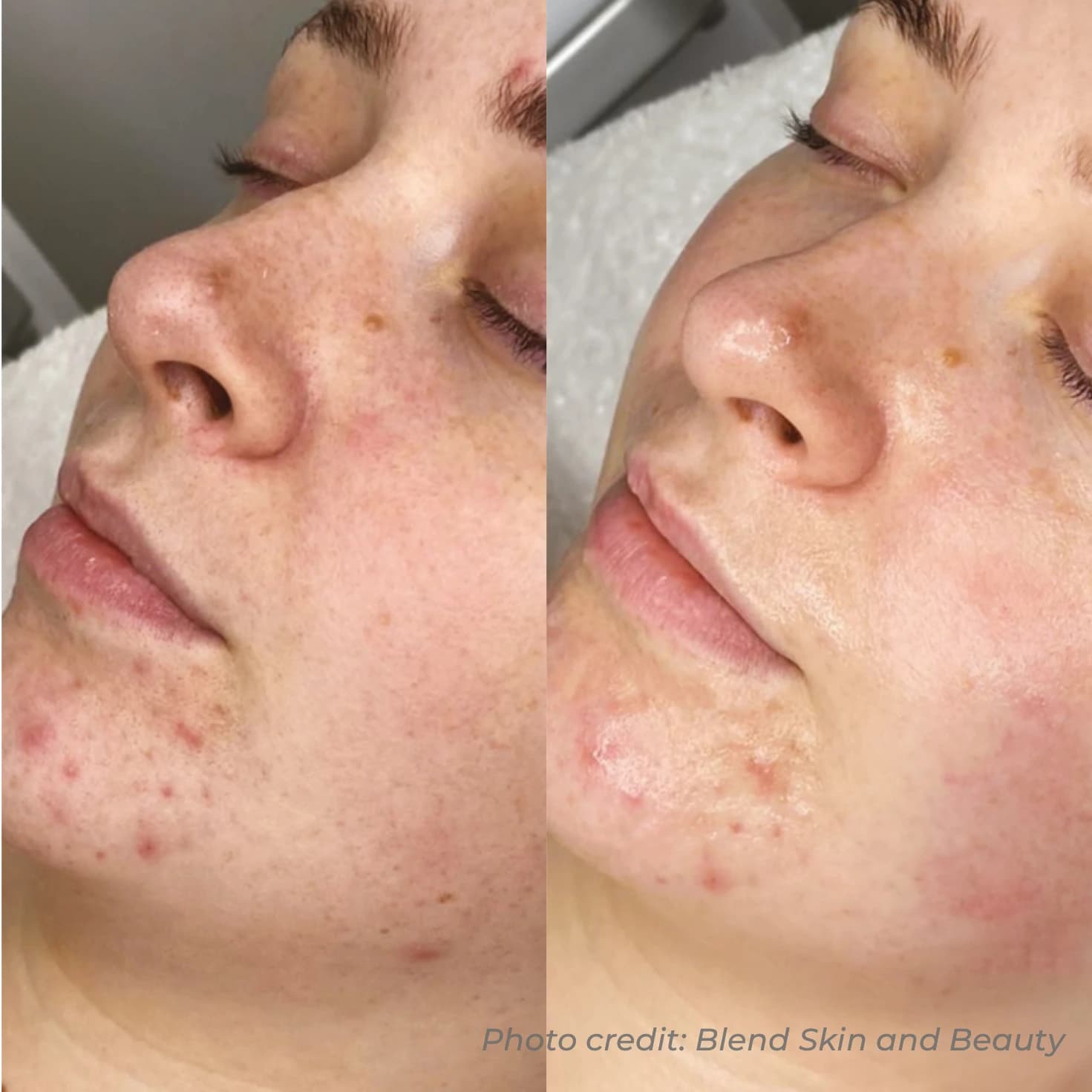 Radiance & Solar Pigmentation Renewal